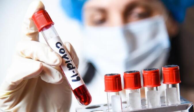 去俄罗斯需要在哪做核酸检测